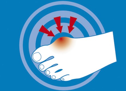 Gesunder Fuß - epitact Epithelium 26® Hallux valgus-Schutz, in Größe L bis S, in Farbe HAUT – Farbe HAUT – Ansicht 