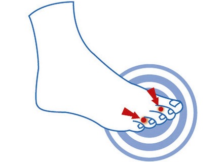 Schuheinlagen - epitact Zehendruckschutzpolster, in Größe 1 (für Damen) bis 2 (für Herren), in Farbe HAUT – Farbe HAUT – Ansicht 