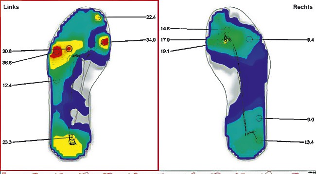 Schuheinlagen - Orthopädische Weichpolstersohle Ansicht 2 Schuheinlagen - Orthopädische Weichpolstersohle, in Größe 001 bis 006, in Farbe BLAU/SCHWARZ Ansicht 2