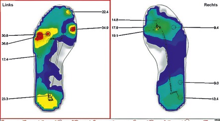 Schuheinlagen - Orthopädische Weichpolstersohle, in Größe 001 bis 006, in Farbe BLAU/SCHWARZ – Farbe BLAU/SCHWARZ – Ansicht 