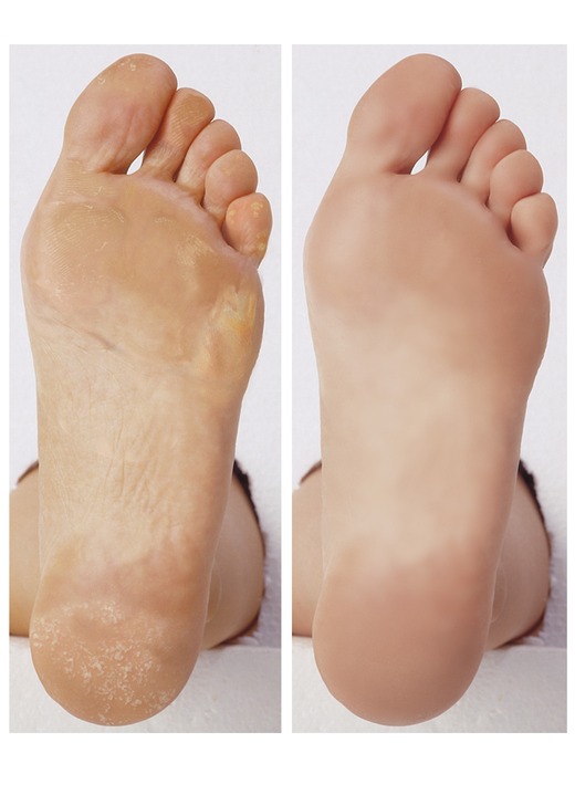 Maniküre & Pediküre - Hornhaut-Balsam, in Farbe , in Ausführung Hornhaut-Balsam Ansicht 2