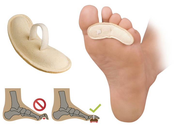 Gesunder Fuß - Zehen-Korrektor, in Größe 001 bis 003, in Farbe HAUT Ansicht 1