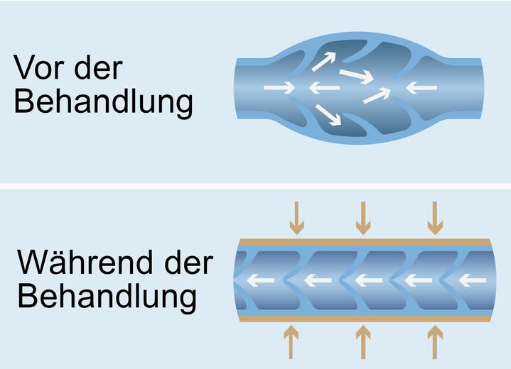 - Vitalmaxx Venen Walker Pro 2 Venen-Massagegerät, in Farbe WEISS/TÜRKIS Ansicht 4