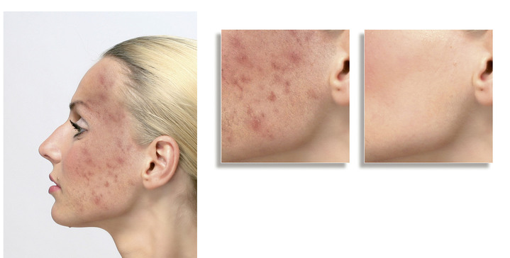 Kosmetik - ELITE Cover Make-up, in Farbe MITTEL Ansicht 3