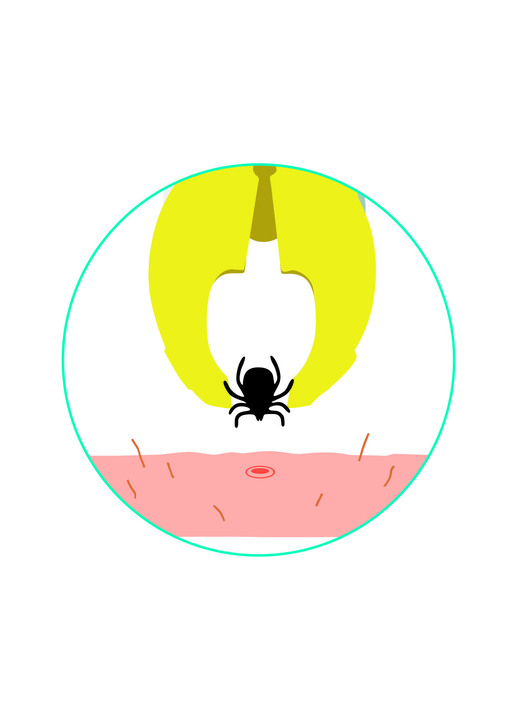 Praktische Hilfsmittel - Zeckengreifer, in Farbe WEISS Ansicht 3