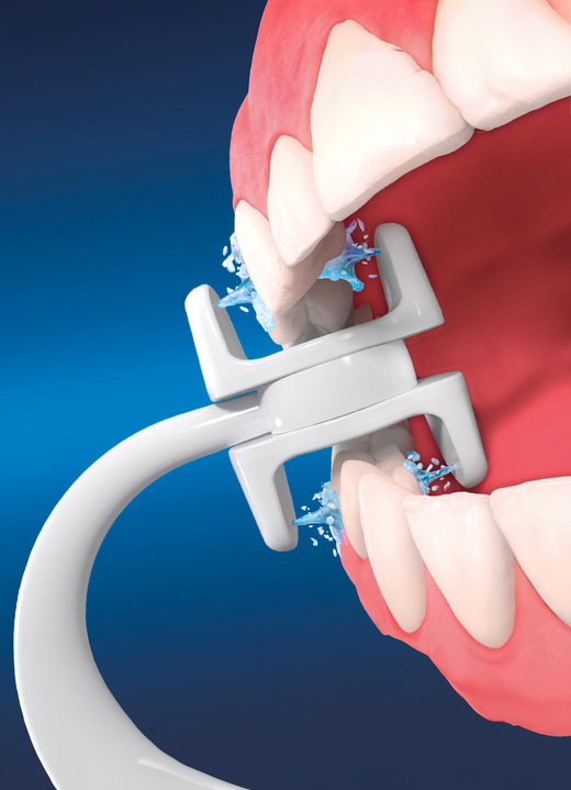 Sonstiges - Zusatzaufsätze für Munddusche Corp Care Miracle Smile, in Farbe WEISS, in Ausführung Spezialaufsätze, 3er-Set Ansicht 3