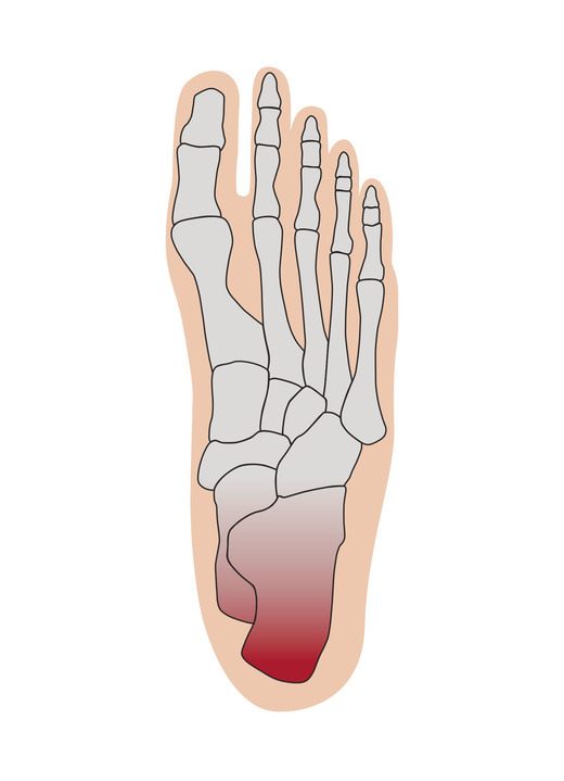 Schuheinlagen - Fersenentlastungspolster, in Größe 001 bis 006, in Farbe LACHS-WEISS Ansicht 2