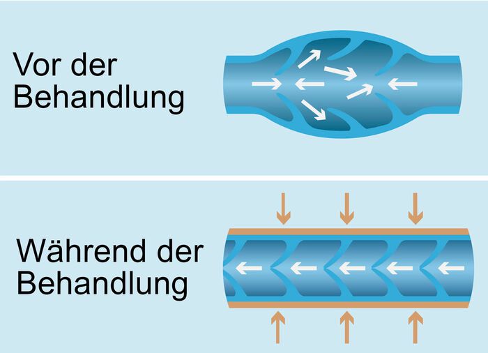 Vitalmaxx Venen Walker Pro 2 Venen-Massageger&auml;t 