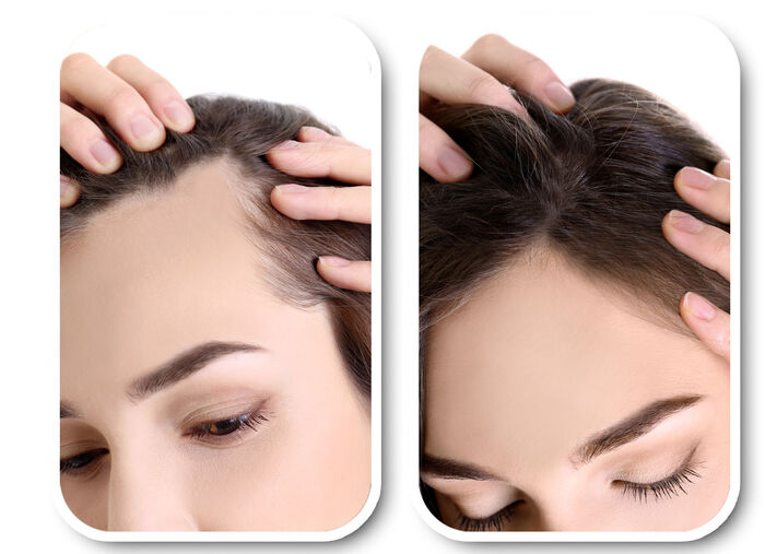 Velform® Nutritional Lotion für jeden Haartyp 