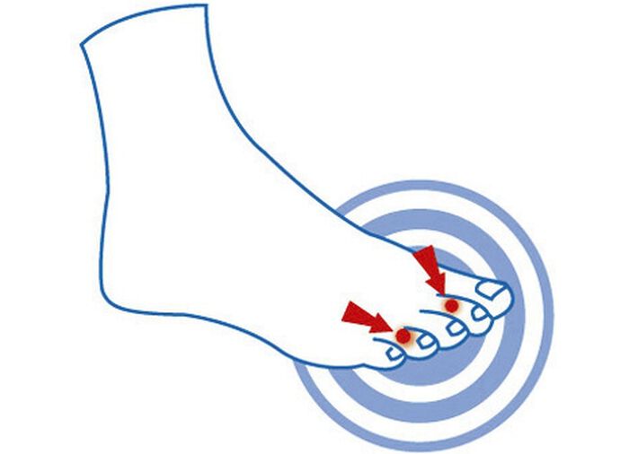 epitact Zehendruckschutzpolster HAUT