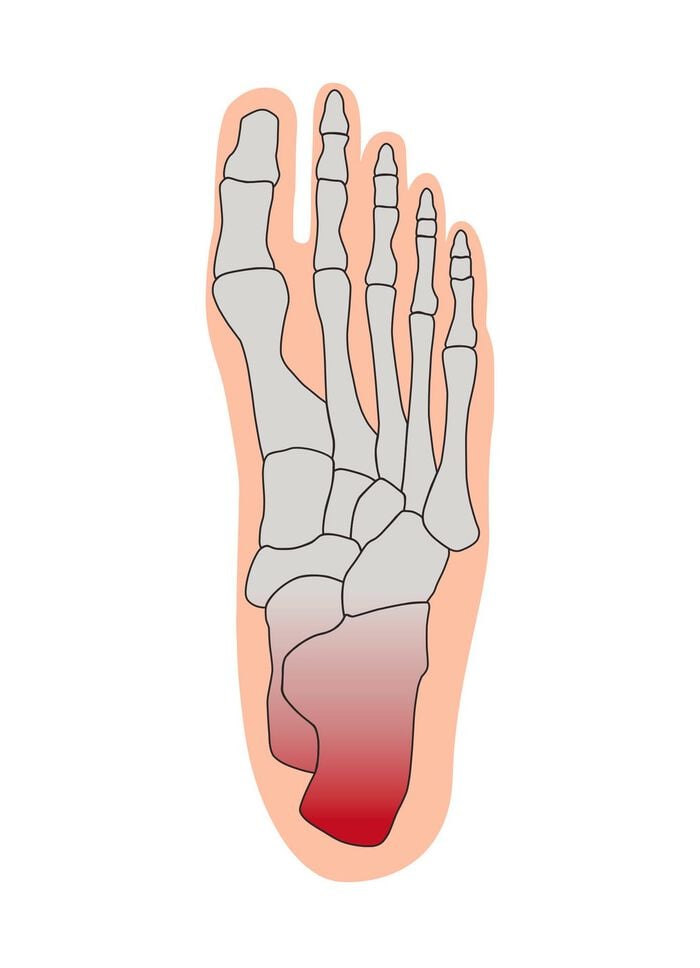 Fersenentlastungspolster 