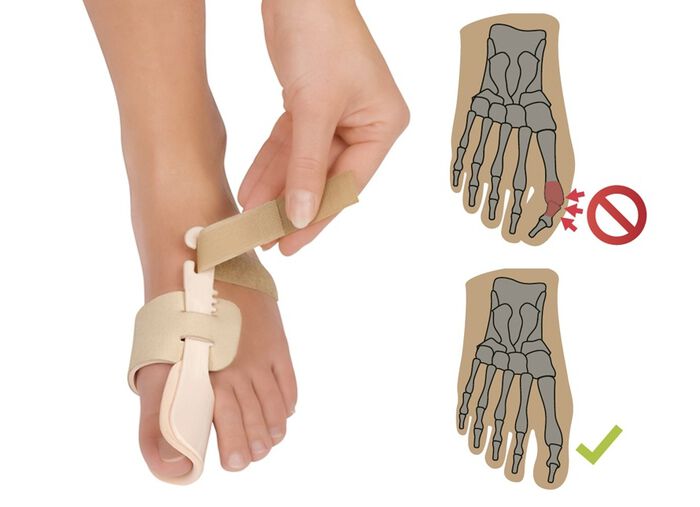 Fu&szlig;Gut Nachtbandage 