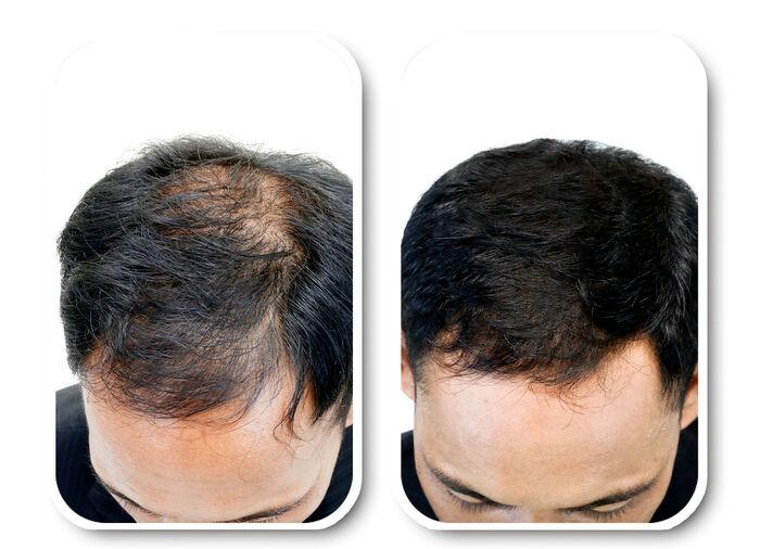 Velform® Nutritional Lotion für jeden Haartyp 