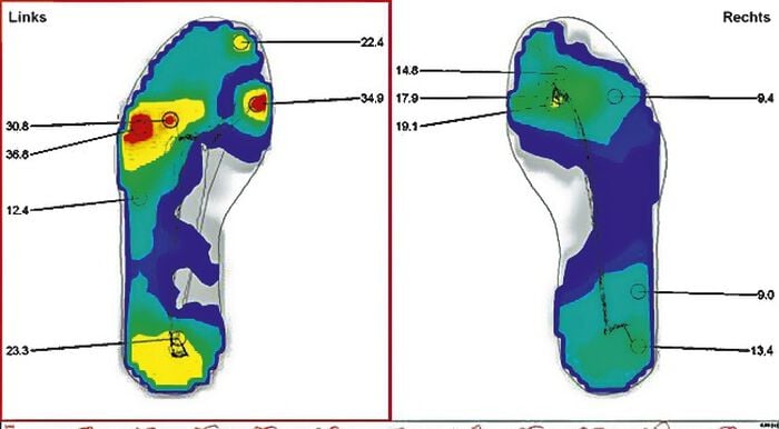 Orthop&auml;dische Weichpolstersohle 